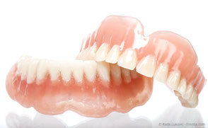 In vielen Fällen kann mit Implantaten festsitzender Zahnersatz an Stelle von Totalprothesen gemacht werden.