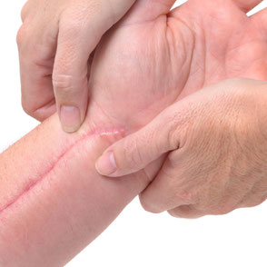 Behandlung von Narben mit Massage