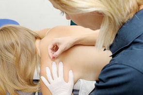 Triggerpunkt / Dry Needling Wellsana Basel Physiotherapie