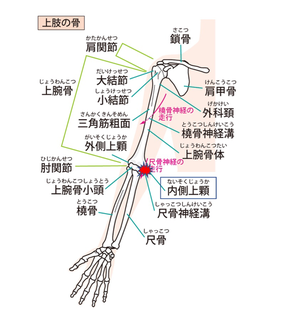 内側上顆の位置。筋肉のけん引力が付着部にストレスを与え炎症が起こる。ゴルフ肘、野球肘