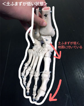 土ふまずが低くなると指が外へ流れます。また、かかとの骨も外側に向いて「>」のような形に。