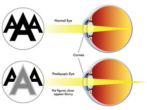 Presbyopia. Natural eyesight improvement. Alternative to glasses. Pinhole glasses. Bates Method Teacher. Bates Method exercises. How to improve my eyesight naturally.