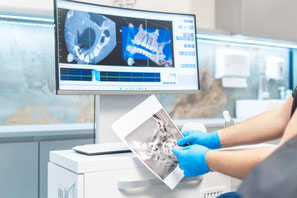 digitale virtuelle 3D-Implantatplanungen