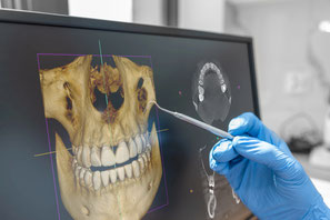digitale Volumentomographie (DVT)