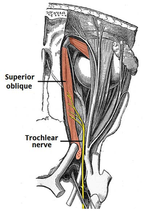 trochlear nerve tract