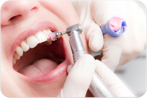 Die beste Maßnahme gegen Mundgeruch ist die regelmäßige Professionelle Zahnreinigung beim Zahnarzt. (© proDente e.V.)