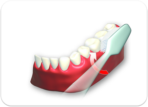 2. Außenflächen der Zähne von hinten links bis rechts hinten oben und unten putzen. (© proDente e.V.)