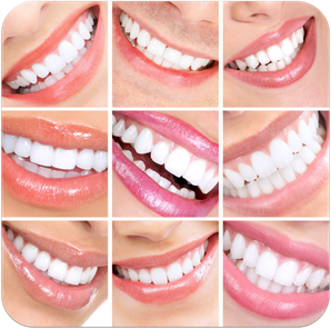 Mit Veneers bleiben Zähne dauerhaft schön und weiß. (© Kurhan - Fotolia.com)