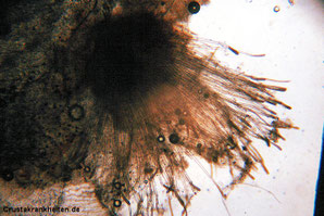Mikroskopische Aufnahme des Wasserschimmels Achlya sp., 100fache Vergrößerung. Foto: Dr. Gerald Bassleer