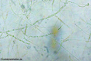 Der Krebspesterreger, Aphanomyces astaci, unter dem Mikroskop. Foto: Dr. Sandra Lechleiter.