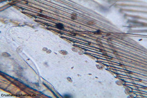 Einzellige Parasiten Tetrahymena bei Garnelen. Der Parasit ist temporär pathogen und kommt als fakultativ pathogener Krankheitserreger bei Stress, schlechten Umweltbedingungen und allgemeiner Schwäche des Wirtes zum tragen. 