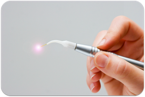 Weichgewebe-Laser für Zahnfleischbehandlungen (© LosRobsos - Fotolia.com)