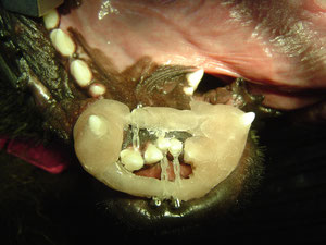 selbstgebaute Zahnspange am Unterkiefer