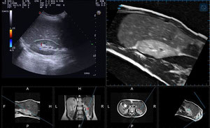 Virtual Navigator - Fusion Imaging - http://medicalidea.jimdo.com - Vendita Ecografi Usati