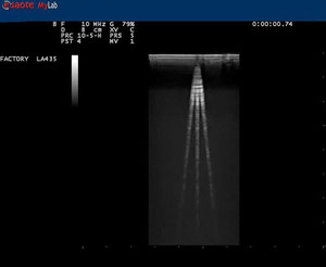 Compound Imaging (sparo multiplo e angolato) - http://medicalidea.jimdo.com - Vendita Ecografi Usati