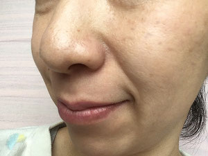 短時間で即効性の高い画期的な方法