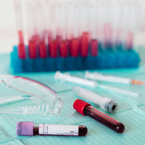 Wenn ihr Fragen zum Thema Blut habt, kommt in die Petra Apotheke Kaiserslautern (apotheke kaiserslautern). Da bekommt ihr Beratung. Von den Experten für Achtsamkeit und mentale Gesundheit.