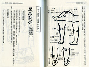 台湾低周波ツボ療法膝と足部治療