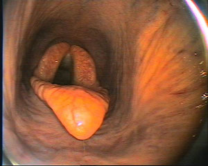 Kehlkopf mit Epiglottis (Kehldeckel)