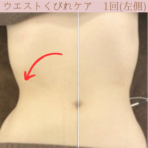 ウエストのくびれ　バストケア　ビフォーアフター