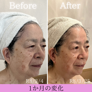 セルラム　ビフォーアフター