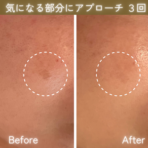 シミケア　ビフォーアフター