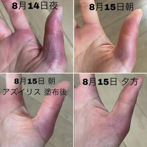 アズイリス　ビフォーアフター