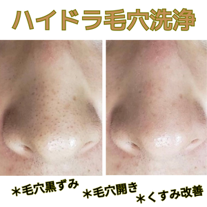 ハイドラフェイシャル　角質ケア　ビフォーアフター