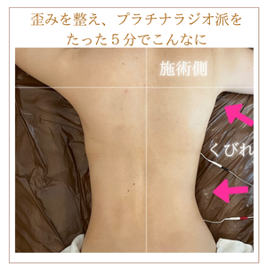ウエストくびれ　ビフォーアフター