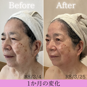 セルラム　ビフォーアフター