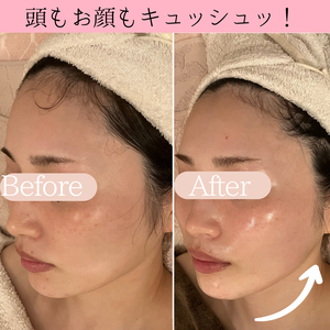小顔ケア　ビフォーアフター