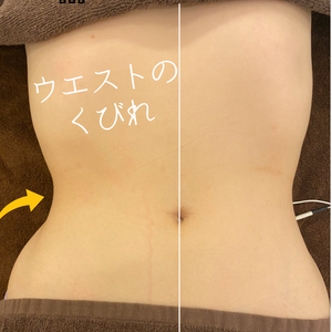 美脚・美尻効果　ビフォーアフター