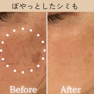 セルラム　ビフォーアフター