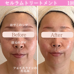 セルラム　ビフォーアフター