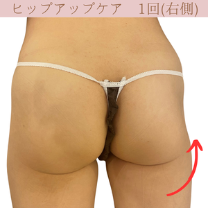 美脚・美尻効果　ビフォーアフター