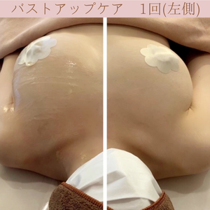 バストアップ　ビフォーアフター