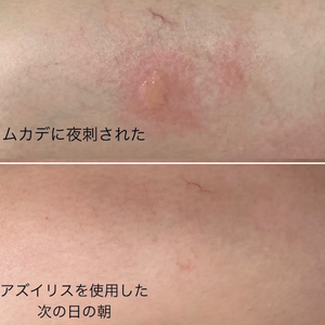 アズイリス　ビフォーアフター