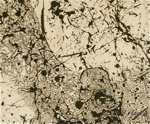 (detail)