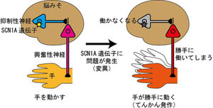 SCN1A遺伝子の変異によるてんかん発作の仕組み Image:子どものてんかんのブログ