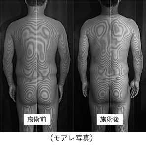 施術の流れ - みのお腰痛セラピー ～ゆらゆらバランス整体～：どこに