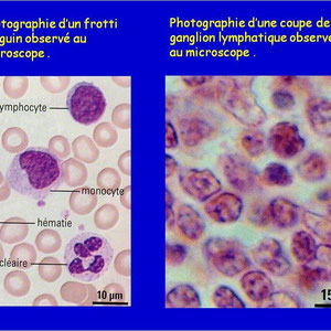 A gauche: leucocytes du sang. A droite nous observons que les leucocytes sont très nombreux dans les ganglions lymphatiques. On peut donc conclure qu'ils sont stockés à cet endroit puis circule dans le corps en cas de besoin.