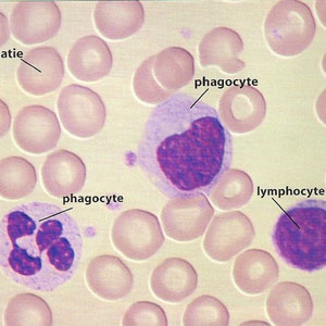 Frottis sanguin: on observe le plasma (en jaune autour des cellules), les hématies (rond roses) et les globules blancs (leucocytes).