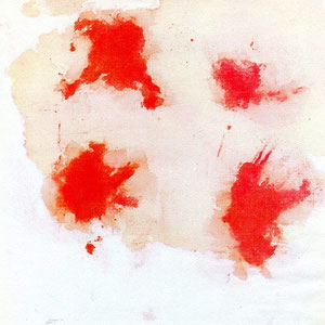 Una "pezzuola", adoperata da Padre Pio, fotografata nel corso delle 24 ore seguenti la sua utilizzazione; evidente la separazione del sangue dalla sierosità [foto tratte da E. Brunatto, "Padre Pio" (livre blanc), Genève 1963]