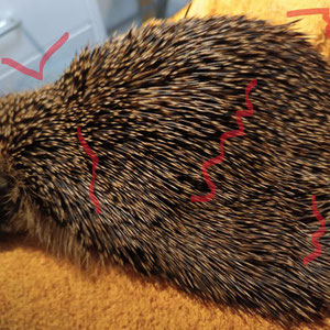 Extremer Hungerknick, Knochen stehen hervor