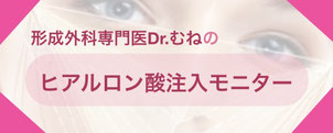 形成外科専門医・保坂宗孝は、ヒアルロン酸注入モニターさんを大募集しております。