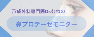 形成外科専門医・保坂宗孝は、鼻プロテーゼモニターさんを大募集しております。