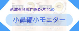形成外科専門医・Dr.むねは、小鼻縮小モニターを募集しております。