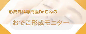形成外科専門医・保坂宗孝は、おでこ形成モニターさんを大募集しております。