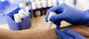 hier ist die Auftragung eines Pricktestes auf der Haut abgebildet