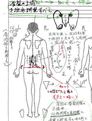 腰痛 左側